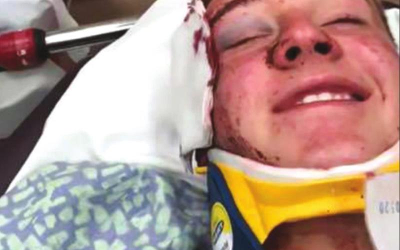 Teen bull rider Gracen Hansen ‘fortunate’ after violent wreck