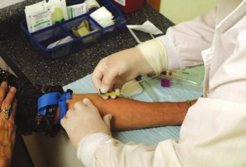 There are no symptoms of high cholesterol, so a blood test is needed to detect this condition.