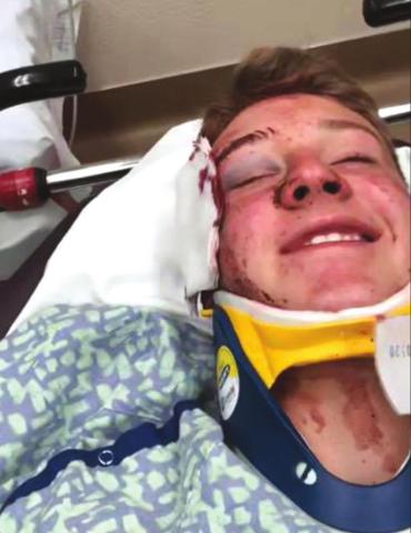 Teen bull rider Gracen Hansen ‘fortunate’ after violent wreck
