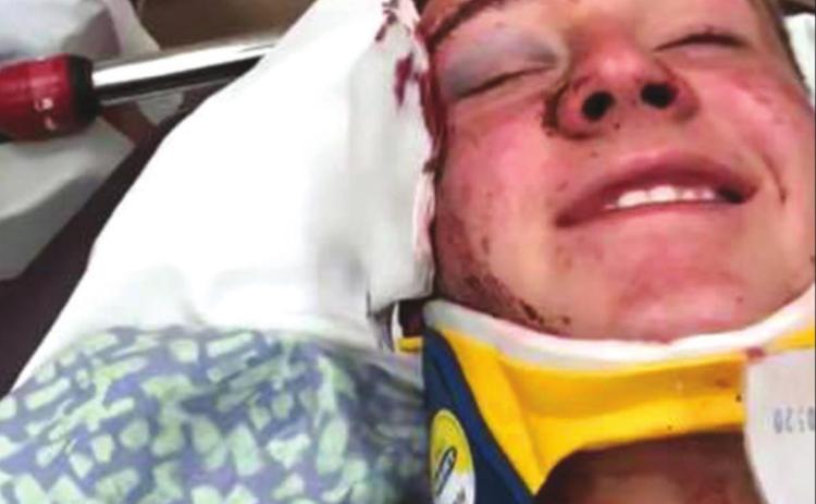 Teen bull rider Gracen Hansen ‘fortunate’ after violent wreck